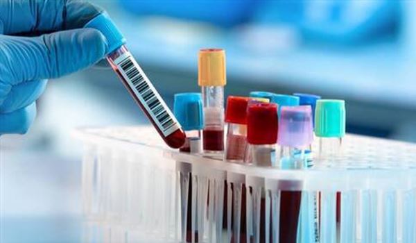 blood test